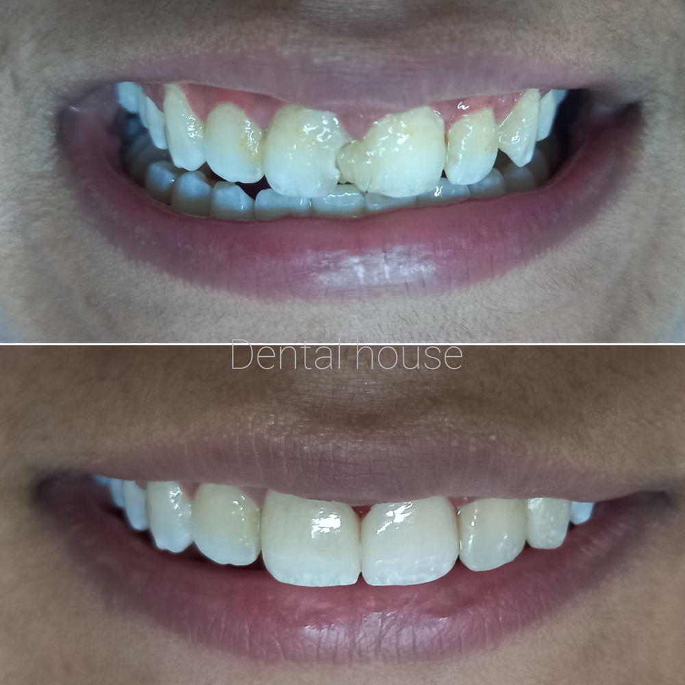 Dental House